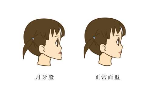 深圳市人民医院正颌手术价格是多少?医院信息及热门项目曝光